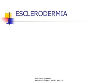 ESCLERODERMIA