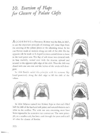 10. Eversion of Flaps for Closure of Palate Clefts 195