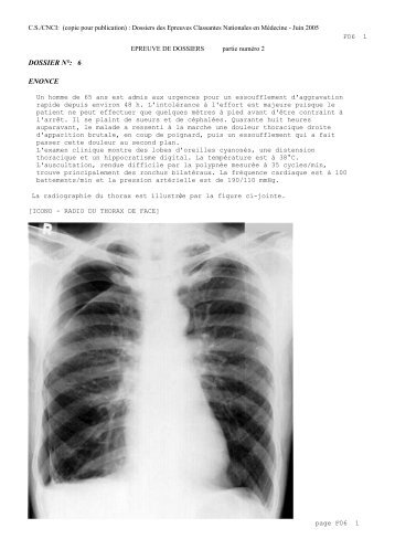 DOSSIER N°: 6 ENONCE - CNCI