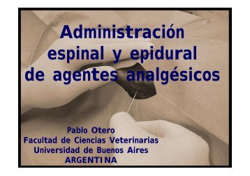 AdministraciÃ³n espinal y epidural de agentes analgÃ©sicos