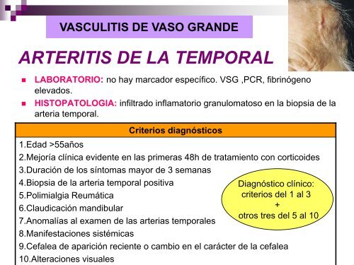 Vasculitis - hgucr