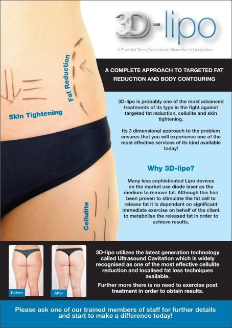 Alternative to Liposuction 4 All Natural Ways to Reduce Cellulite