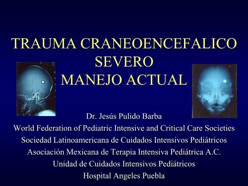 TRAUMA CRANEOENCEFALICO SEVERO_DR JESUS PULIDO BARBA MEXICO