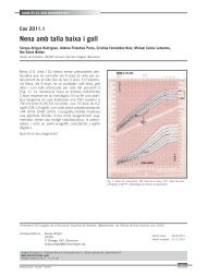 Nena amb talla baixa i goll - Societat Catalana de Pediatria