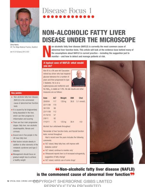 Non-alcoholic fatty liver disease - The British Journal of Primary