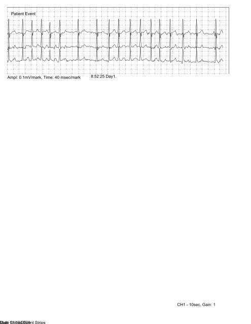 Sample Holter Printout - Nasiff