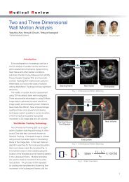 Two and Three Dimensional Wall Motion Analysis - Toshiba Medical ...