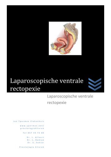 Laparoscopische ventrale rectopexie - Jan Yperman Ziekenhuis