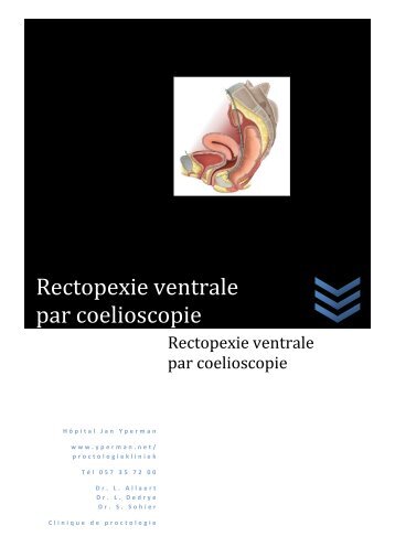 Rectopexie ventrale par coelioscopie - Jan Yperman Ziekenhuis