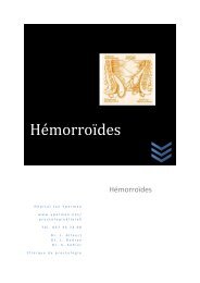 HÃ©morroÃ¯des - Jan Yperman Ziekenhuis