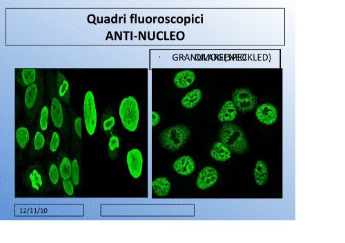 il laboratorio nella diagnostica delle epatopatie autoimmuni