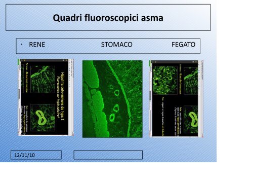 il laboratorio nella diagnostica delle epatopatie autoimmuni