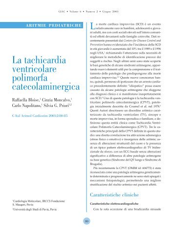 La tachicardia ventricolare polimorfa catecolaminergica - Giornale ...