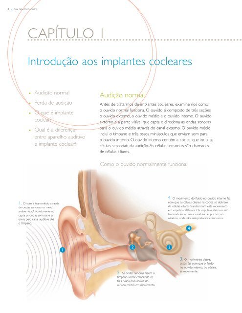 Guia do sistema de implante coclear NucleusÂ® para ... - Cochlear