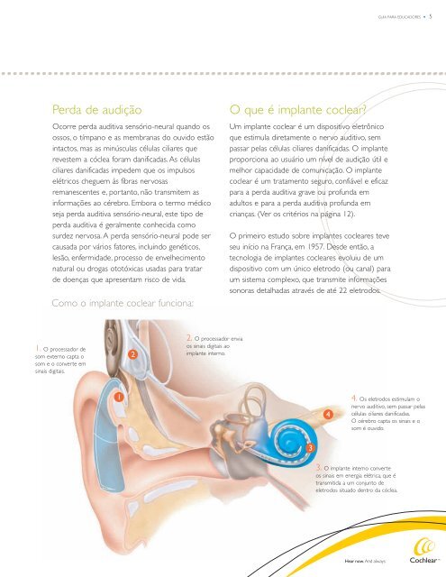 Guia do sistema de implante coclear NucleusÂ® para ... - Cochlear