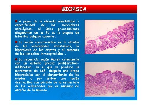 Enfermedad celÃ­aca.pdf