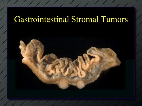 GIST Pathology PowerPoint by Dr. Rosenberg - The Life Raft Group