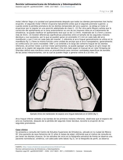 MANEJO DE ESPACIO DE LEEWAY EN DENTICIÃN MIXTA ...