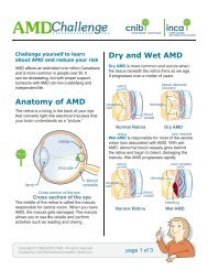 Anatomy of AMD Dry and Wet AMD - CNIB