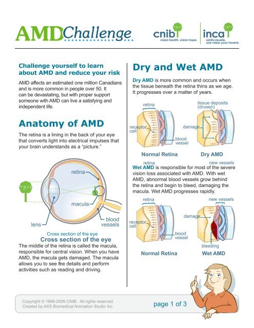 Anatomy of AMD Dry and Wet AMD - CNIB
