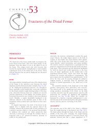 Chapter 53 Fractures of the Distal Femur