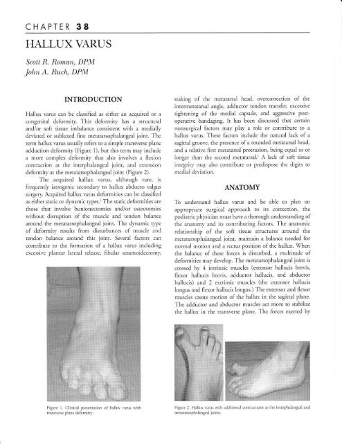 Hallux Varus - The Podiatry Institute