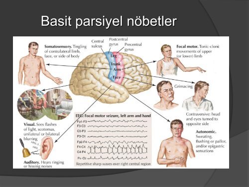 cocukluk donemi paroksismal hastaliklar.pdf