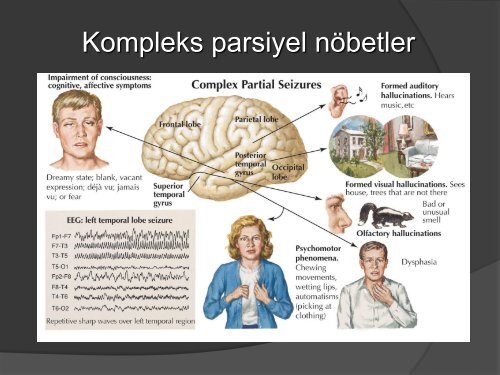 cocukluk donemi paroksismal hastaliklar.pdf