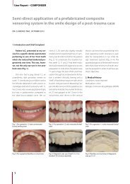 Semi-direct application of a prefabricated composite veneering ...