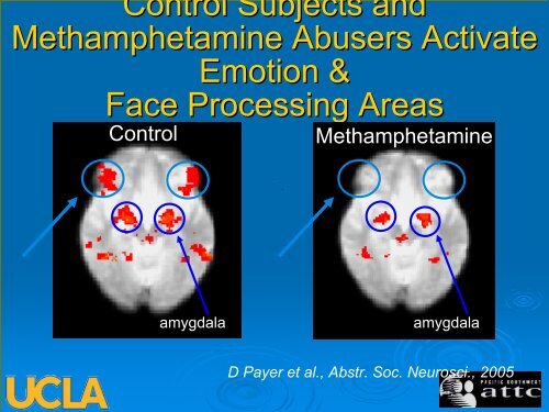 Methamphetamine - UCLA Integrated Substance Abuse Programs