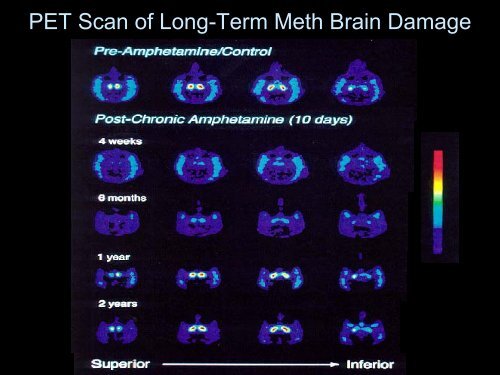 Methamphetamine - UCLA Integrated Substance Abuse Programs