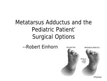 Metatarsus Adductus and the Pediatric Patient' Surgical Options