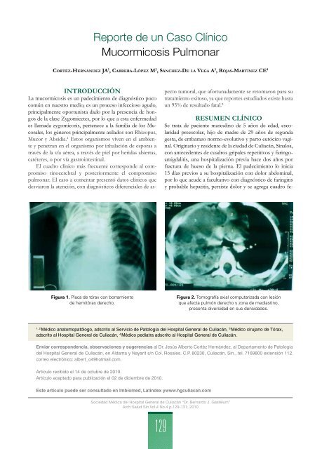 Reporte de un Caso ClÃ­nico Mucormicosis Pulmonar - Hospital ...