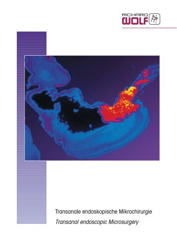 Transanal endoscopic Microsurgery - Richard Wolf