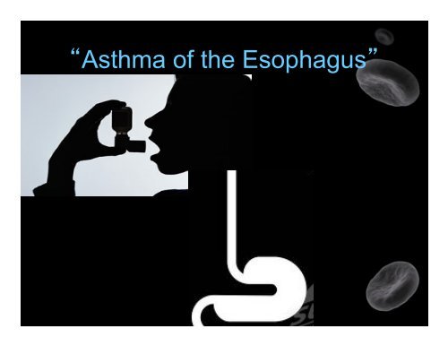 Eosinophilic Esophagitis - Healthcare Professionals