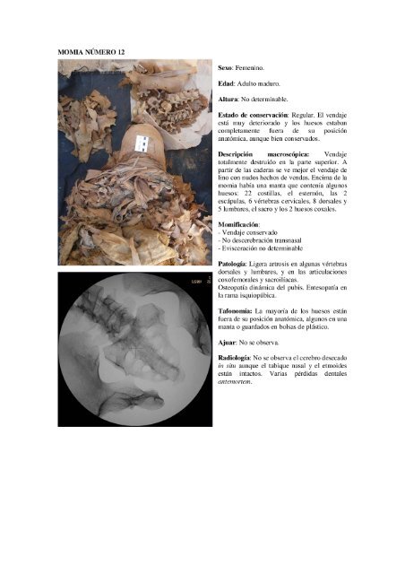 estudio antropolÃ³gico, paleopatolÃ³gico y radiolÃ³gico de las momias ...