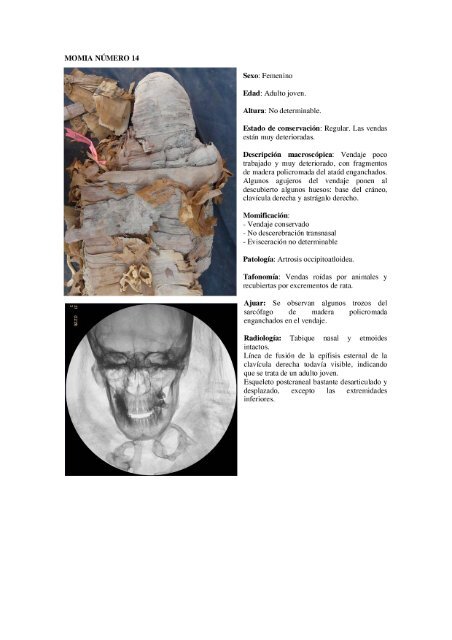 estudio antropolÃ³gico, paleopatolÃ³gico y radiolÃ³gico de las momias ...
