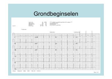 Practische beoordeling ECG - ICverpleegkundige.com