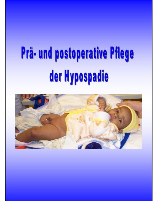 PrÃ¤- und postoperative Pflege der Hypospadie. Liedl Sabine - Salk