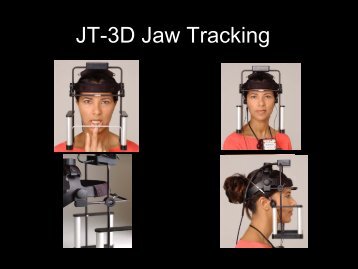 JT-3D Jaw Tracking