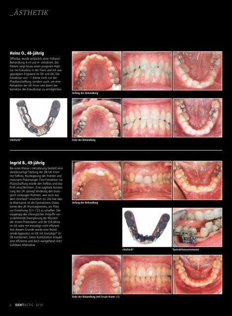 implantologie - Dentastic
