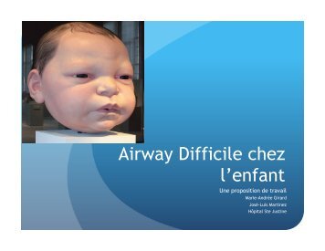 Airway Difficile chez l'enfant - CHU Sainte-Justine - SAAC