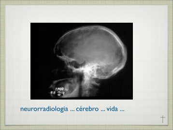 neurorradiologia ... cÃ©rebro ... vida ...