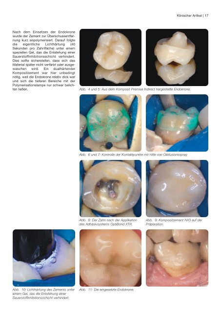 Kerr News - kerrdental.ch