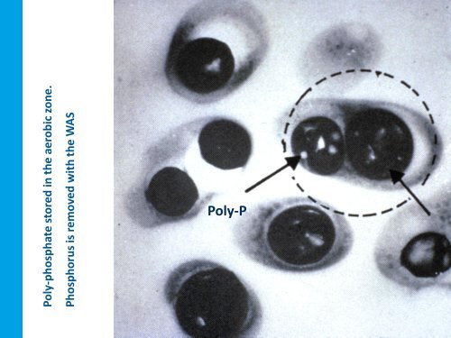 anaerobic zone