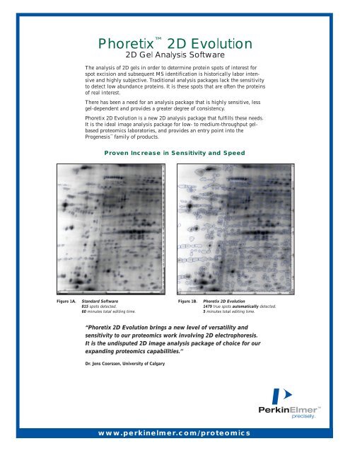 Phoretixâ¢ 2D Evolution: 2D Gel Analysis Software - PerkinElmer