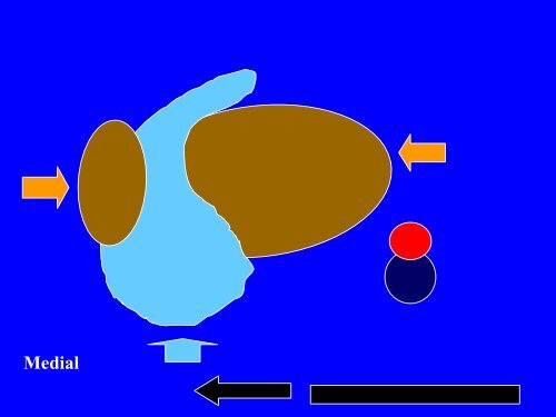 Anatomy Physiology DVT