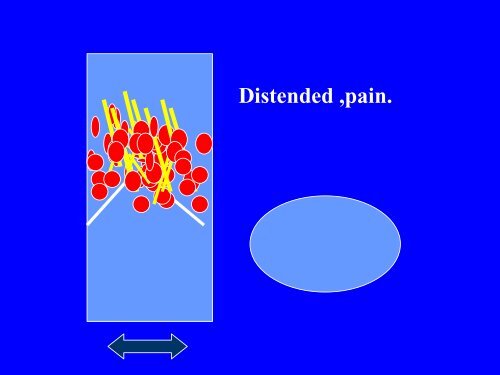 Anatomy Physiology DVT