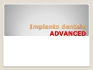 Impianto dentale ADVANCED - TFD Implantologia