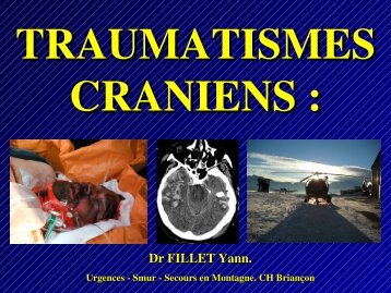 Traumatisme cranien, Dr Fillet - Association Nationale des MÃ©decins ...